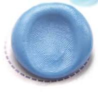 <p>Impression deposited in a material that retains the 3D shape of the ridge detail</p><p>ex. Wax, putty, grease</p>