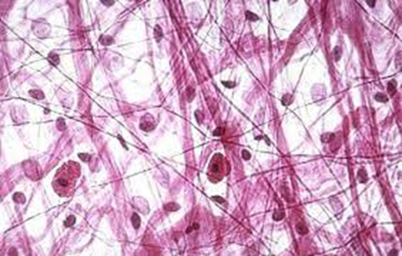 <p>What tissue type is this?</p>