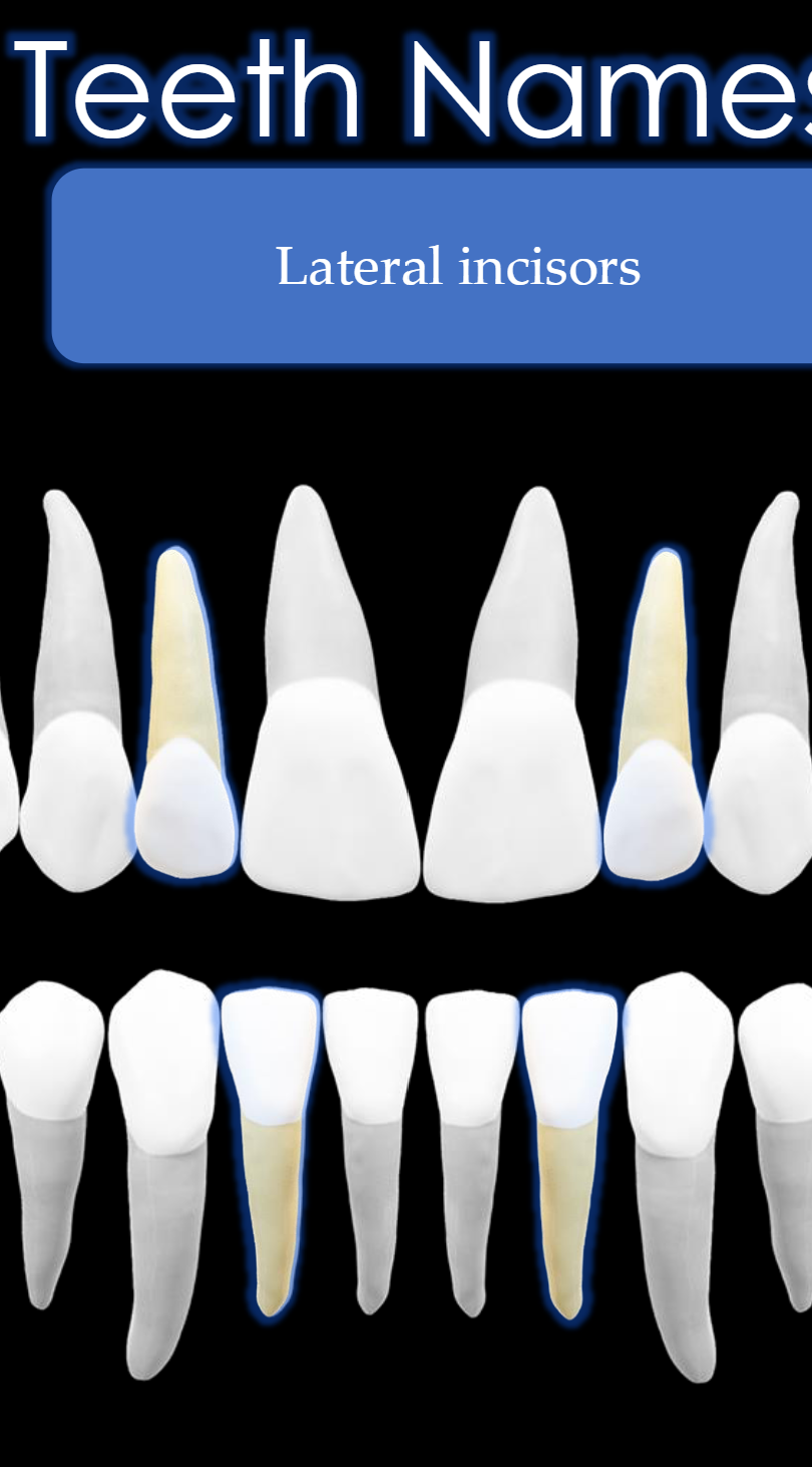 <p>Teeth #: 7,10,23,26</p>