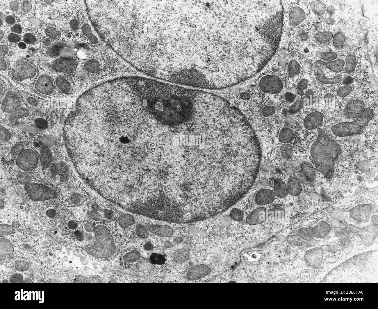 <p>A beam of electrons passes through ultrathin sections of a specimen, then through an electromagnetic lens, then focused on a projector lens</p><p>Specimens may be stained with heavy-metal salts for contrast</p>