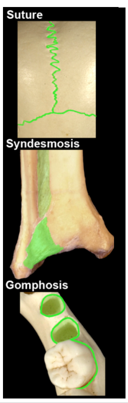 <ul><li><p>Sutures</p></li><li><p>Syndesmosis</p></li><li><p>Gomphosis</p></li></ul><p></p>