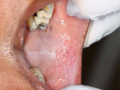 <p>ID the anatomic variant:</p>