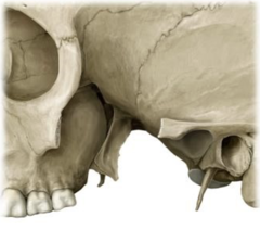 <p>Boundaries of the pterygopalatine fossa</p>