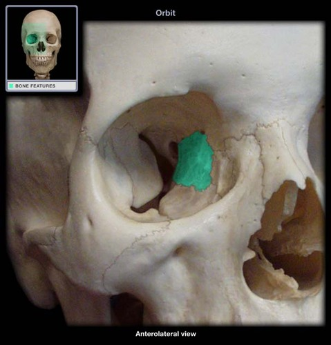 <p>What part of the skull is this?</p>