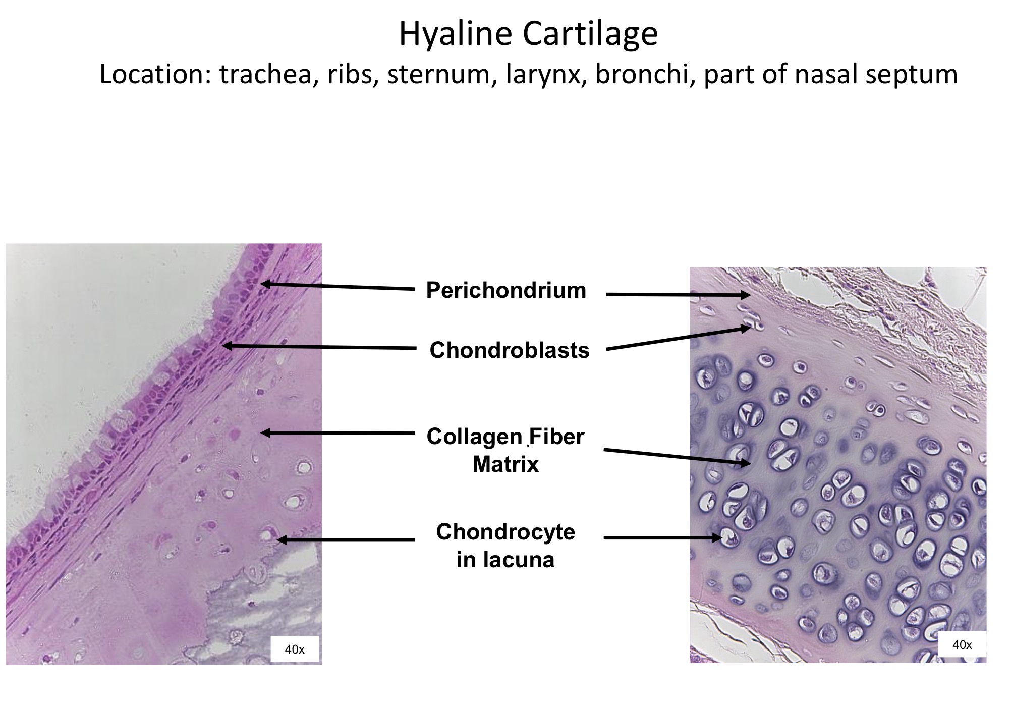 <ol><li><p>Perichondrium</p></li><li><p>Chondroblasts </p></li><li><p>Collagen fibers matrix </p></li><li><p>Chondrocyte in lacuna </p></li></ol><p></p>