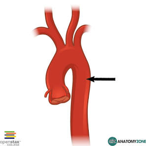<p>Identify the structure indicated by the arrow</p>