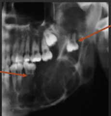 <p>What is the abnormality of each arrow?</p>