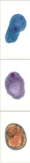 <p>cyst has one large glycogen vacuole, troph is slluggish with large central karyosome</p>
