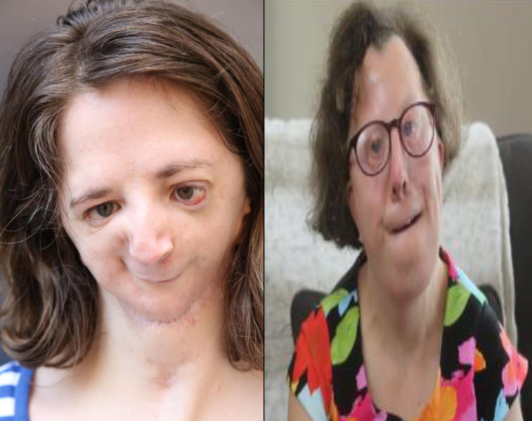 term image