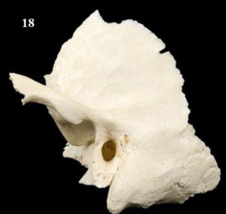 <p>What Bone is This?</p>