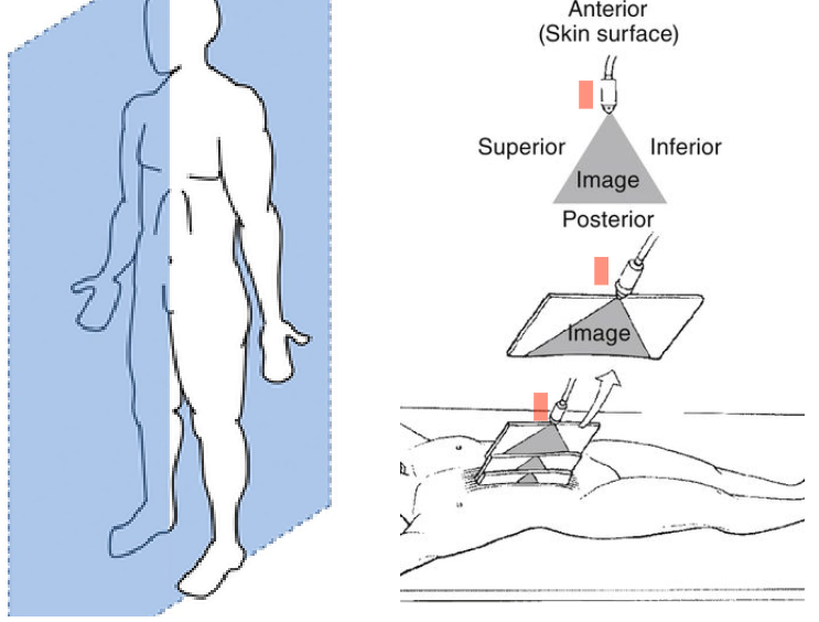 <p>Longitudal, long</p><p>Divides body into left and right</p><p>Transducer indicator notch towards patient’s head</p>