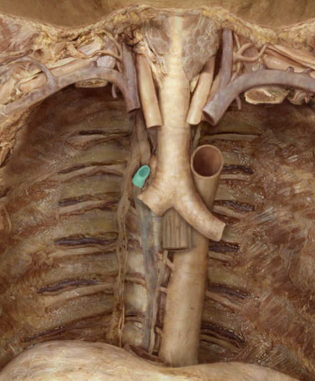 <p>Identify the feature of the caval system</p>
