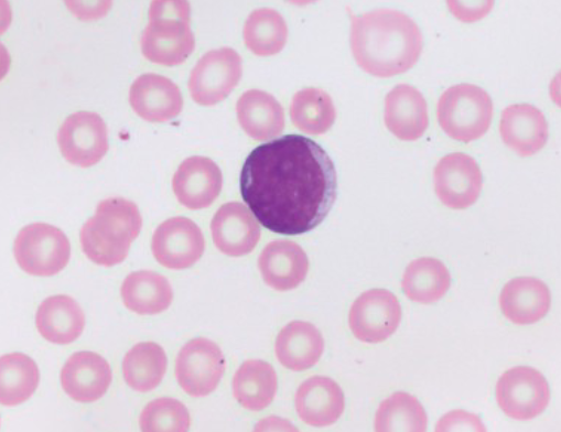 <p>What WBC precursor is this?</p>