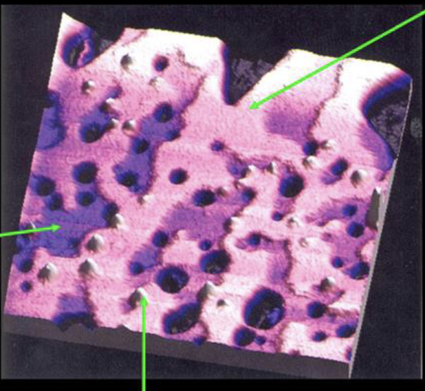 <p>what does the pink area of this image represent (top left arrow)</p>