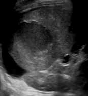 <p>Identify this image. </p>