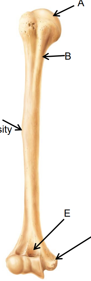 <p>What bone is this? What view of the bone is this?</p>