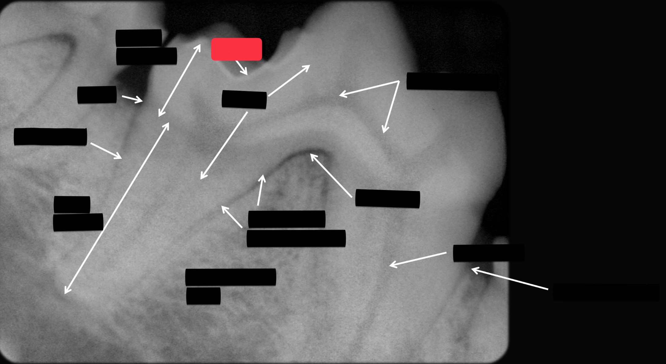 <p>Label this part of the tooth.</p>