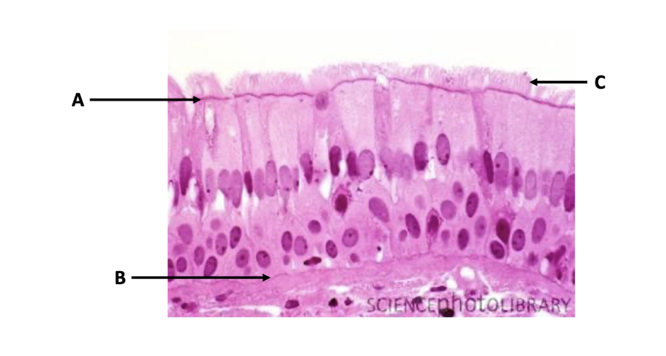 <p><br>Identify the structure labeled C.</p>