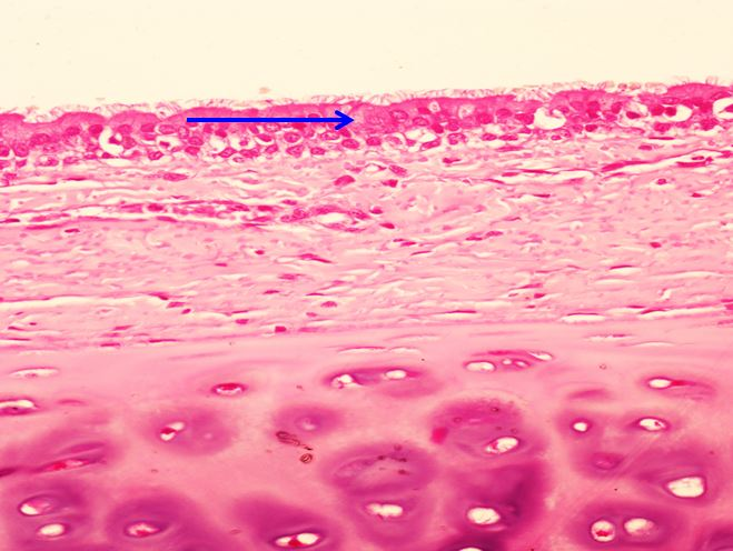 <p>Biểu mô gì ?</p>