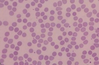 <p>What type of blood cells are these?</p>