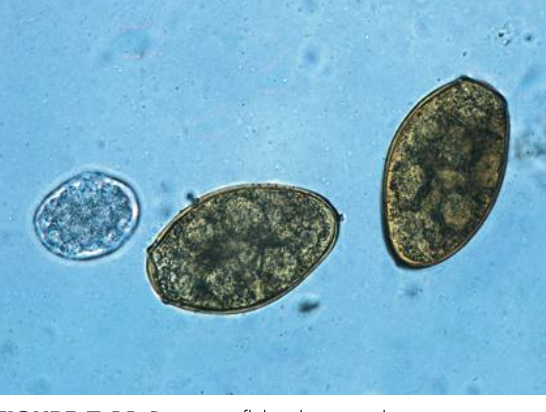 <p>Operculated egg- looks like a door on one side (pole) of the egg</p>