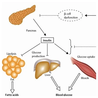 <p>Insulin production</p>