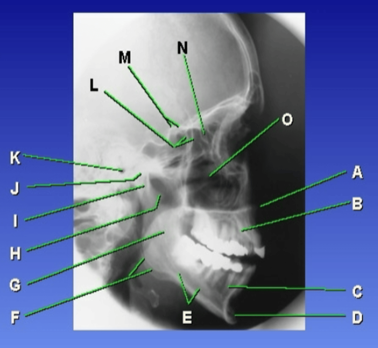 <p>E</p>