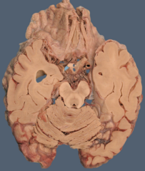 <p>What structure is highlighted in blue</p>