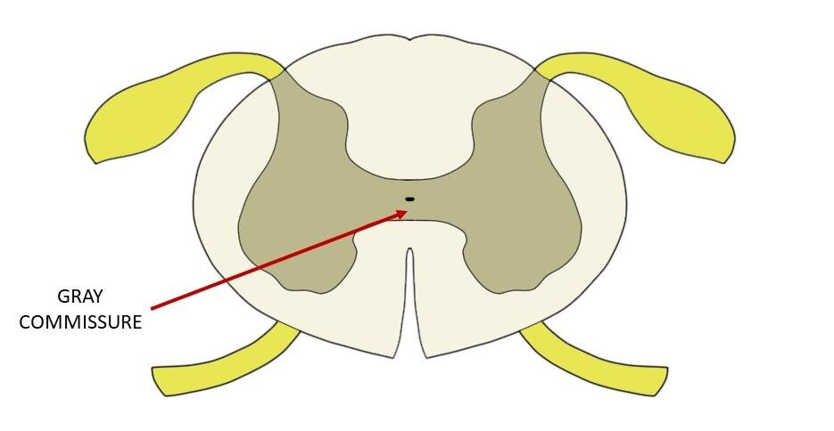 <ul><li><p><strong>Location: </strong>At the center of the spinal cord, surrounding the small central canal (which contains CSF) and bridges the H-shaped columns of gray matter (between the anterior/ventral horn and posterior/dorsal horn)</p></li><li><p><strong>Description: </strong>Thin, horizontal strip of gray matter that connects the left and right halves of the spinal cord</p></li></ul><p></p>