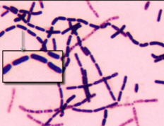 <p>What morphology?</p>