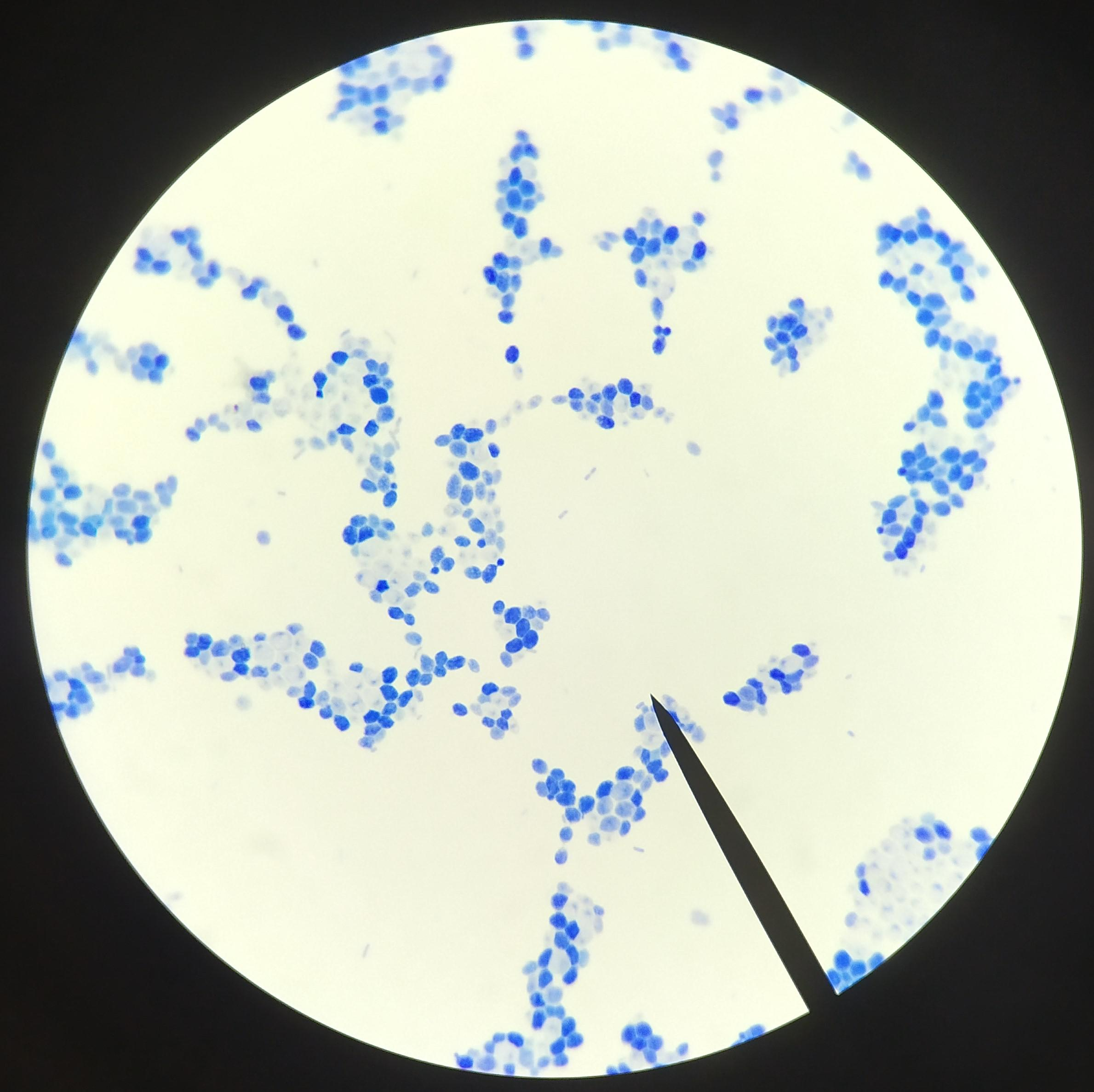 <p>All of the following statements correctly describe the yeast Rhodotorula rubra, except:</p><p>It has been isolated from dairy products, air, soil, and water</p><p>It is the most common fungal cause of diaper rash</p><p>It has been identified as a nosocomial pathogen</p><p>It has been found as a contaminant or commensal in specimens of urine, sputum, and feces</p><p>It has been found to cause endotoxic shock</p>