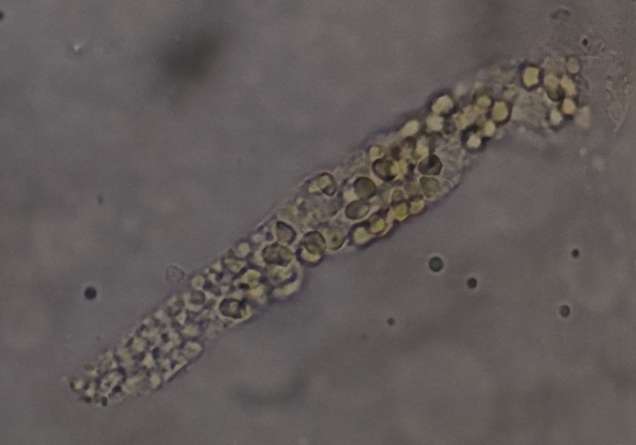 <p>What type of cast is this?</p>