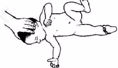 <ul><li><p>primitive relfex - brainstem</p></li></ul><ul><li><p>supine turn their head. upper extremity on same side will extend and opposite will flex into the “fencing” position</p></li></ul><p></p>