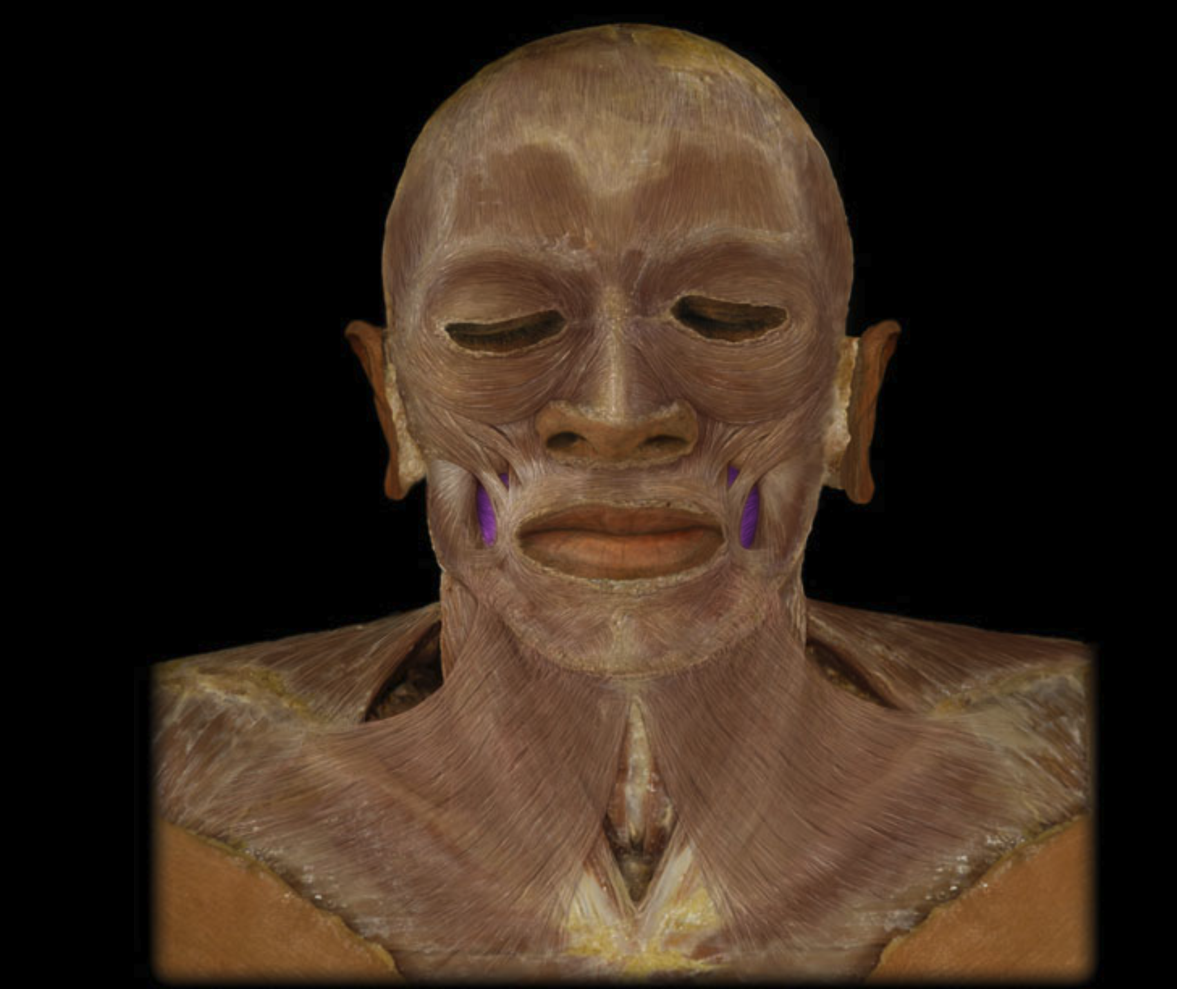 <p>muscle that helps with chewing and forcefully blowing air, located in the cheek area.</p>