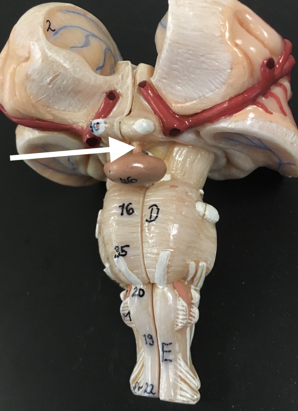 <p>What is the pink stalk the arrow is pointing to?</p>