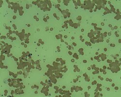 <p>when RBC clump like grapes bc antigens are sticking, dangerous</p>