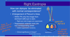 <p>When Panum's area is enlarged with normal correspondence, what is the result of this?</p>