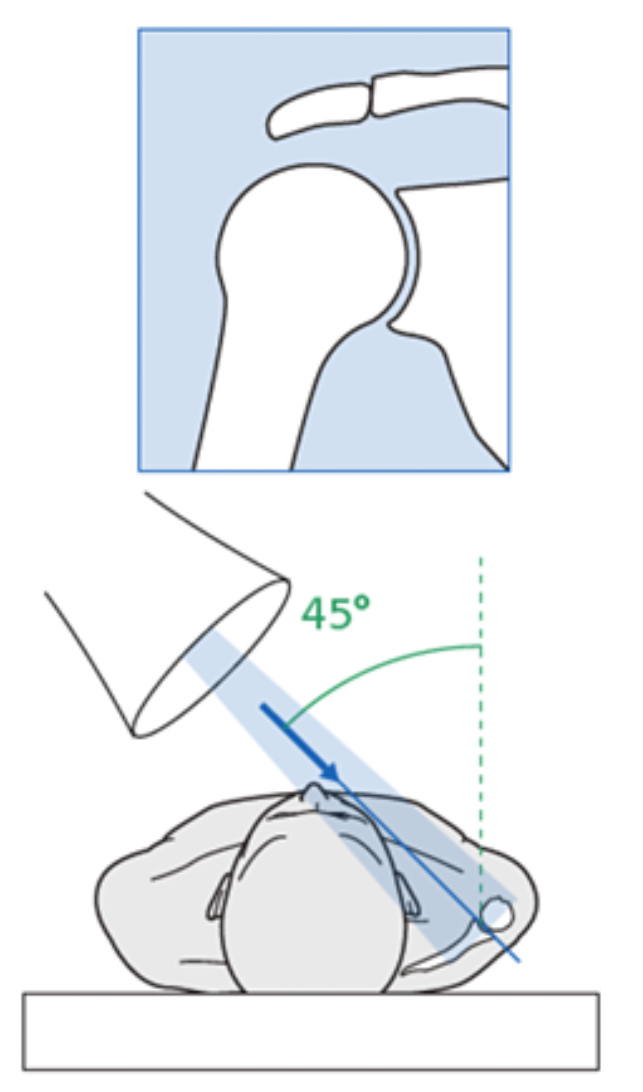 <p>35-45 degrees</p>