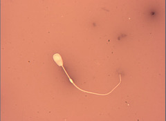 <p>What is this? Normal or abnormal sperm?</p>