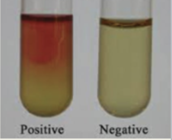 <p>What differential test is used to determine the ability of bacteria to ferment glucose via the butanediol pathway?</p>