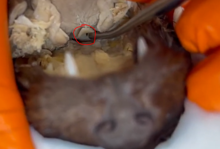 <p>What is this opening to the trachea </p>