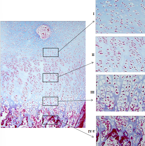 <p>kremzlinės osteogenezės sritys: </p>