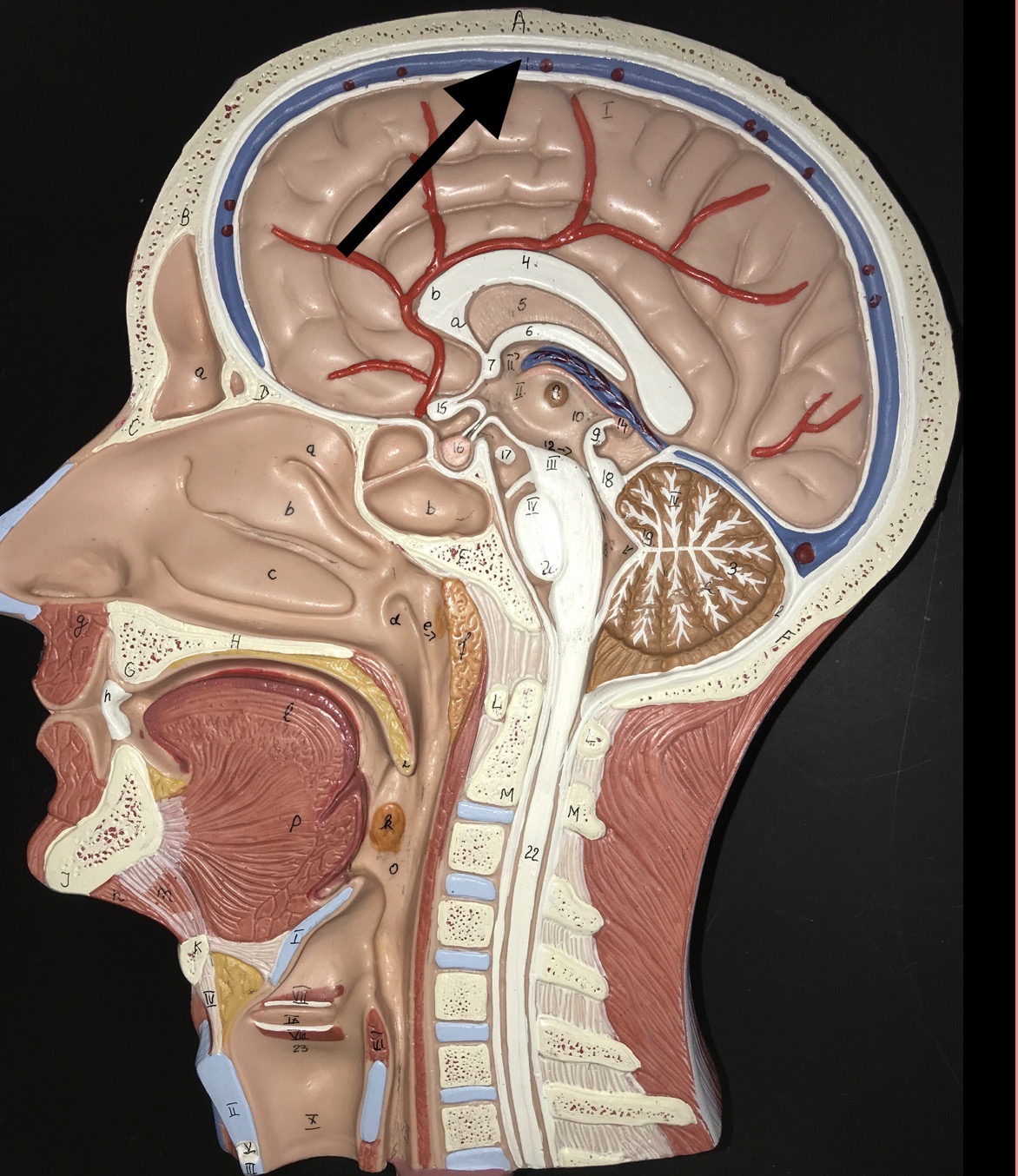 <p>What is the blue structure the arrow is pointing to?</p>