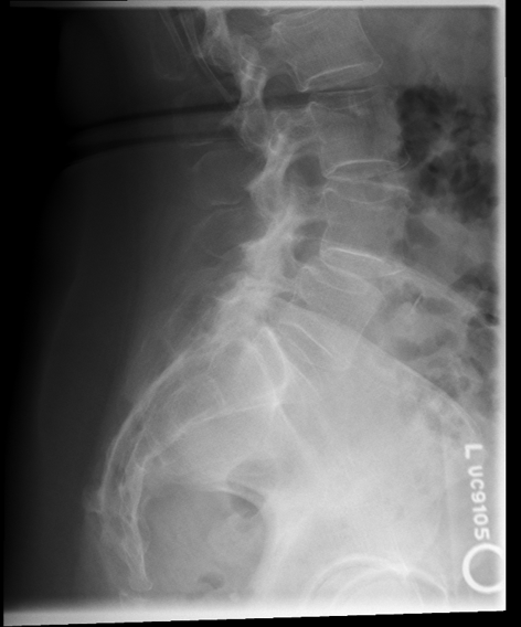 <p>critique this sacrum lateral</p>