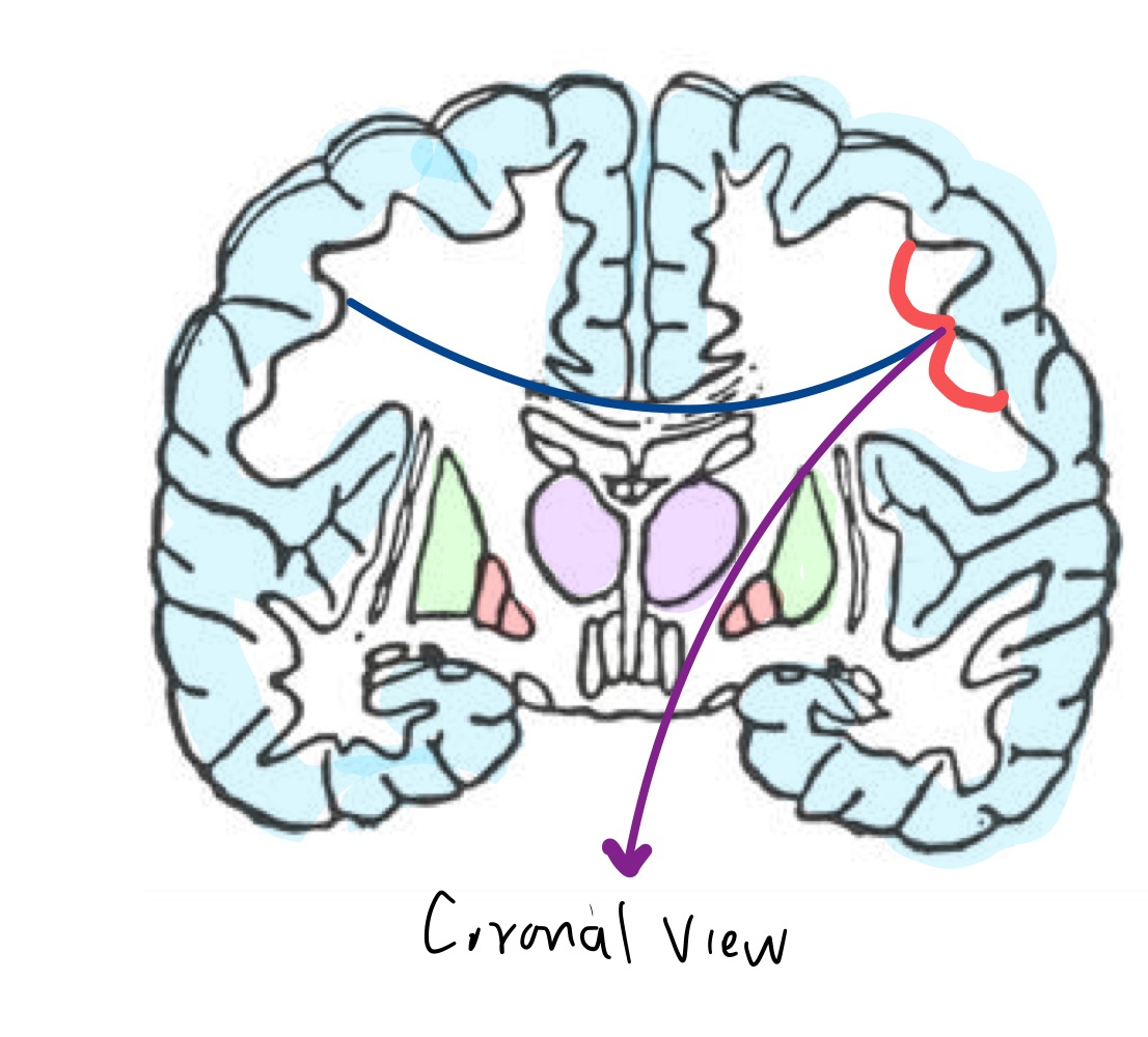 <p>What gray matter structure does the red shaded region represent? </p>