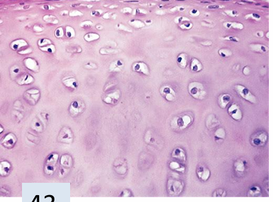 <p>what tissue is this? </p>