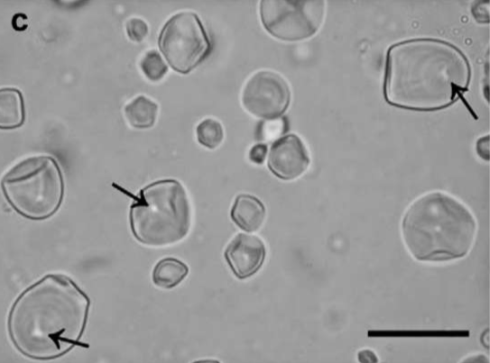 <p>Identify the following starch granules</p>