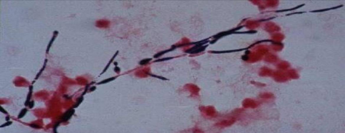<p>Specimen (microscopically slide):</p><p>• Name of organism:</p><p>• Stain:</p><p>• Sample from: culture or pus or in tissue</p><p>• Morphology</p>