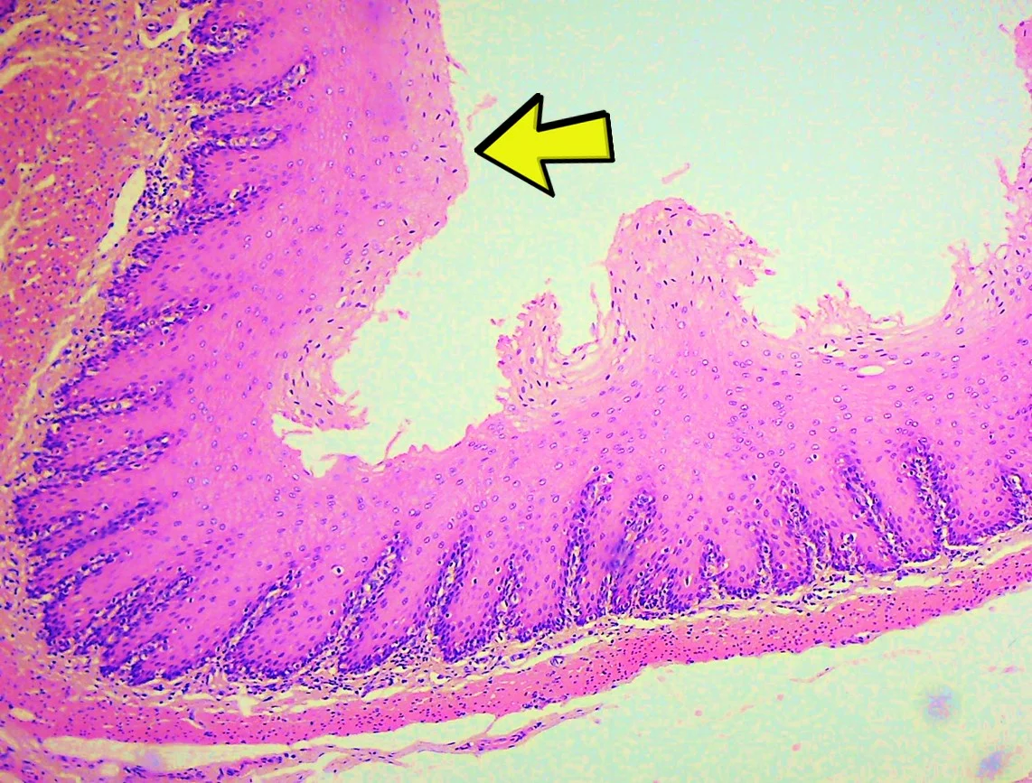 <p><span>Identify the tissue in the micrograph at the yellow arrow.</span></p>