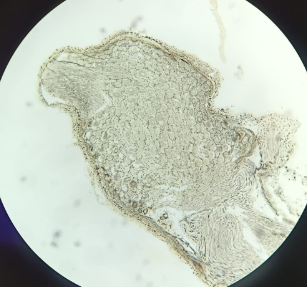 <p>Omentum Majus Simple Squamous Epithelium - Silver Impregnation (AgNO3) (34a)</p><ul><li><p>Part of the Peritoneum, which forms unique serous membrane (serosa)</p></li><li><p>built of simple squamous epithelium (mesothelium)</p></li><li><p>look from the top (surface) cells are polygonal</p></li><li><p>nuclei are not visible</p></li><li><p>Cells connect thanks to interdigitations</p></li></ul><p></p>